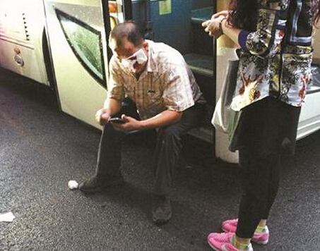 北京豪车游客打峨眉司机 观光车司机左眼被打或失明