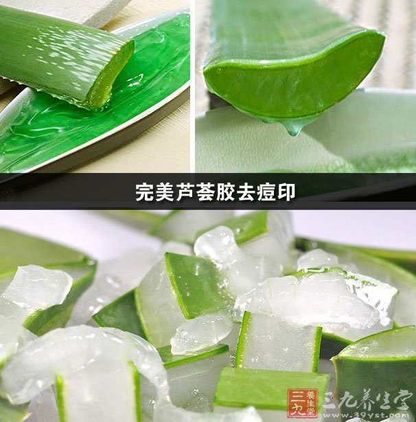 完美芦荟胶去痘印