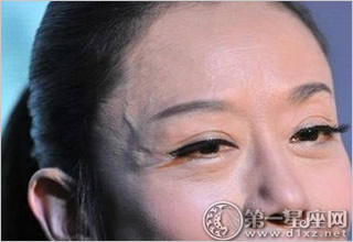 夫妻宫见青筋 夫妻宫见青筋